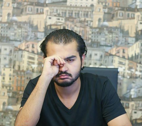 عينى فيها حساسية